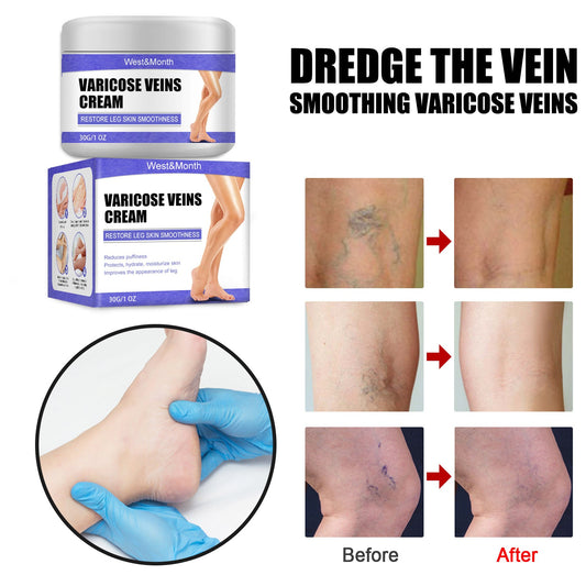 VeinCare Fading Cream